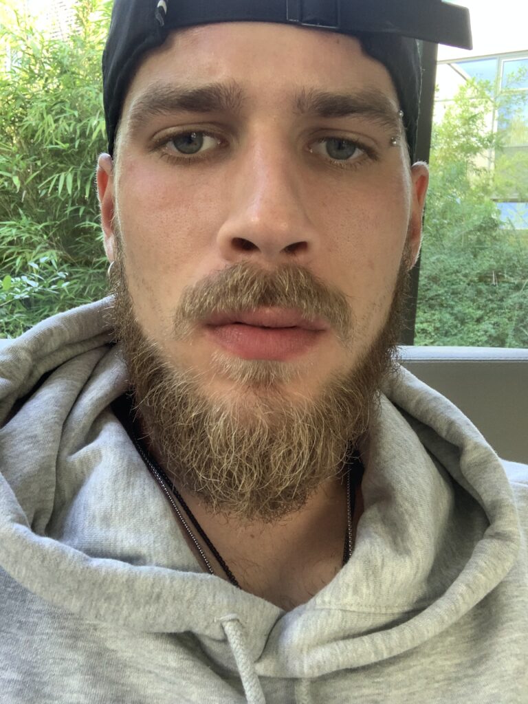 Profilfoto von Mickie – öffentliches CALUMA Kandidatenprofil